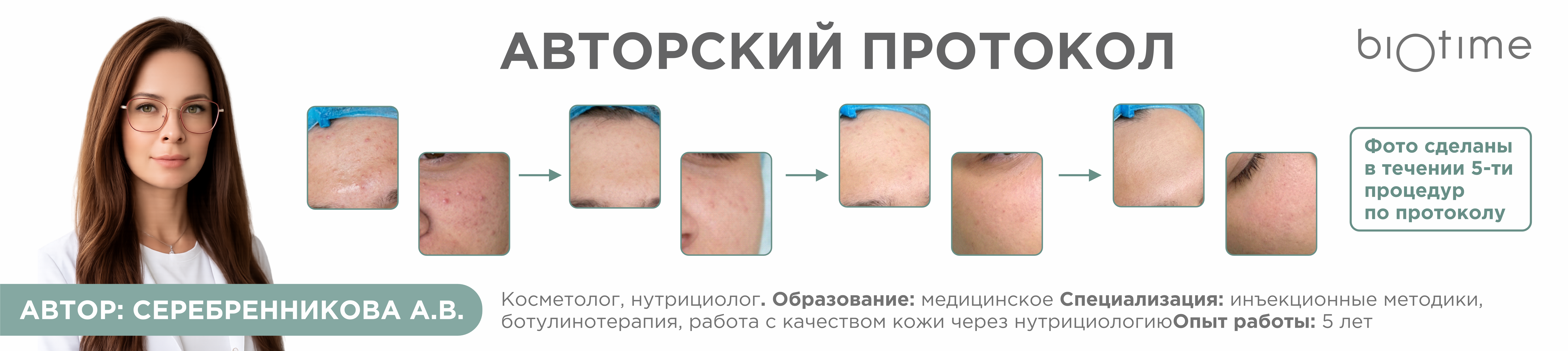 Активная коррекция акне у подростков с сохранением барьерной функции
